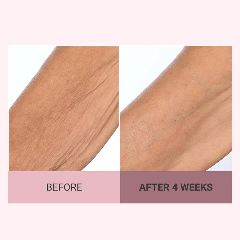 💆♀️ Experience Ultimate Luxury - 79% OFF - ✨ Champagne Beaute Lift Firming Body Crème - For Firmer, Smoother, Radiant Skin! 🌟