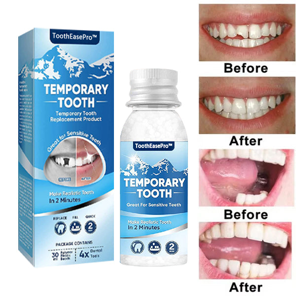 🦷 ToothEasPro™ Dental Filling Gel – Pain-Free, Drill-Free Cavity Solution💖💖