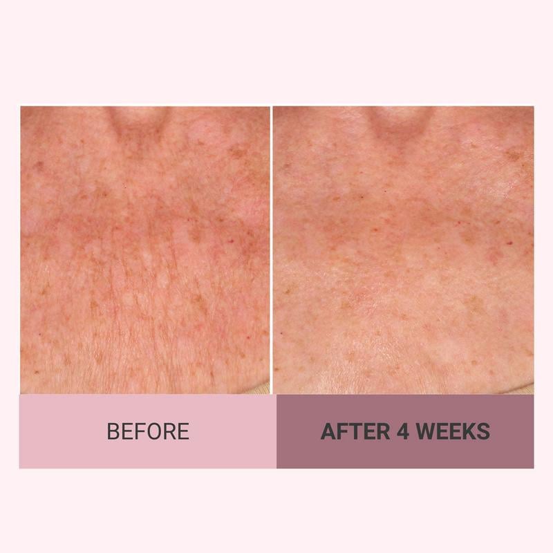 💆‍♀️ Experience Ultimate Luxury - 79% OFF - ✨ Champagne Beaute Lift Firming Body Crème - For Firmer, Smoother, Radiant Skin! 🌟