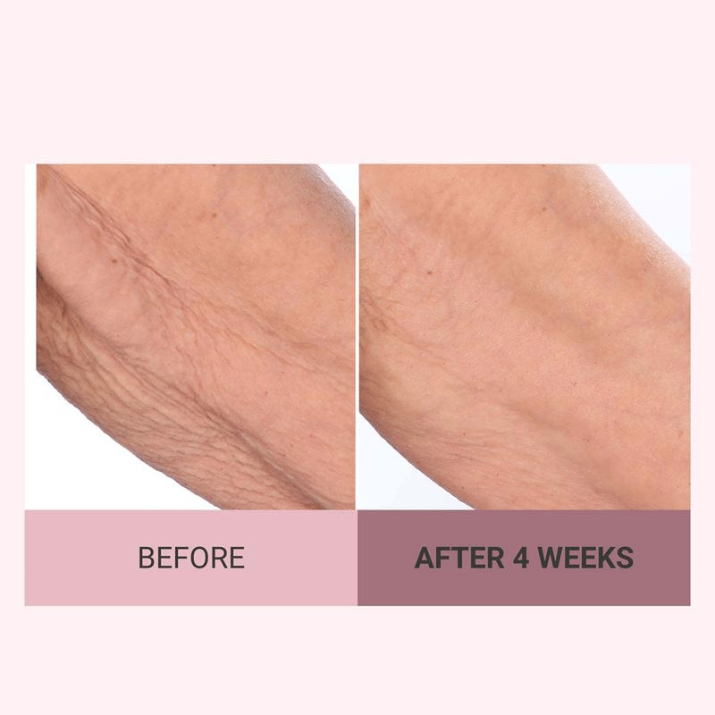 💆‍♀️ Experience Ultimate Luxury - 79% OFF - ✨ Champagne Beaute Lift Firming Body Crème - For Firmer, Smoother, Radiant Skin! 🌟